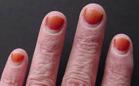 hennapage com henna encyclopedia fingernails n