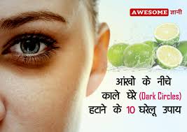 home remes for dark circles under