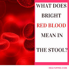 If you have blood in stool and are concerned if this is something worth worrying about, then this article will help you determine how serious your symptoms really are, and whether you need emergency. Bright Red Blood In Stool No Pain Child Hemorrhoid Or Fissure