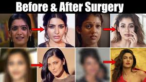 Newer post older post home. Top Heroines Before And After Plastic Surgery Samantha Nayanthara Shruti Haasan News Buzz Youtube