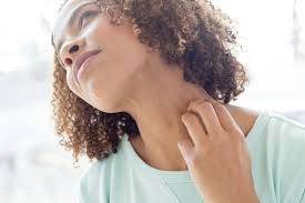 neck rash causes and how to treat and