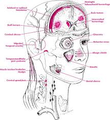 Headache Google Search Hand Reflexology Pressure Points