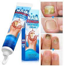 cream for fungal nail infection