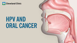 head and neck cancer symptoms causes