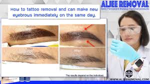 eyebrows tattoo removal remove and