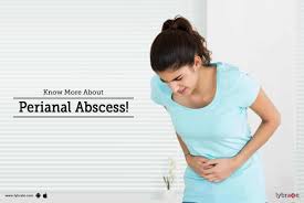 know more about peri abscess by