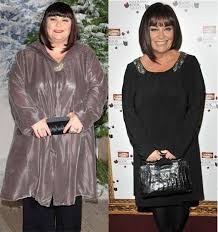 * i am not dawn french *** you are at this page because you love dawn french. How To Approach Fashion If You Ve Lost A Lot Of Weight Like Dawn French Wales Online