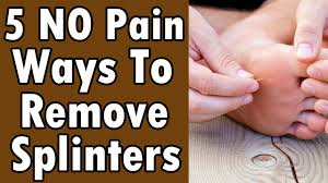 10 home remes to get a splinter out