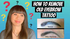 remove old and dark eyebrow tattoo