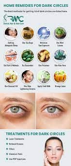 how to remove dark circles under eyes