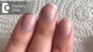 bluish discoloration of nail beds