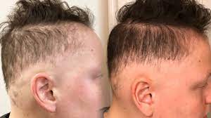 Well you are wrong, because even reviewers with straight promising review: Clients With Alopecia Or Thinning Hair Here S What You Can Do To Help