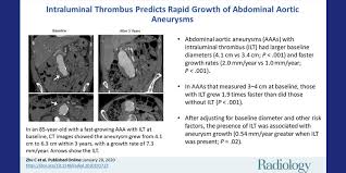We are located in the berkeley place shopping center in bluffton, sc. Newly Published Research Reports An Important Discovery About Abdominal Aortic Aneurysms Aaas Ucsf Radiology