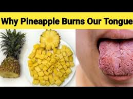 why does eating pineapple burns our