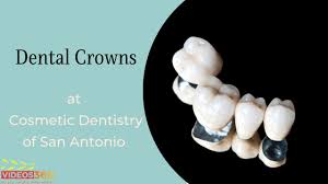 dental crowns san antonio tx get a