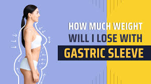 gastric sleeve surgery