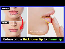 reduce of the thick lower lip fat lip