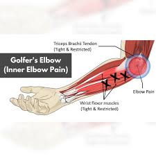 golfer s elbow pain root cause