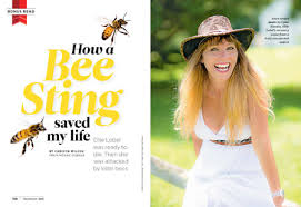 First, it's important to immediately remove the stinger from your skin, if it's still there. How A Bee Sting Saved My Life Reader S Digest Asia