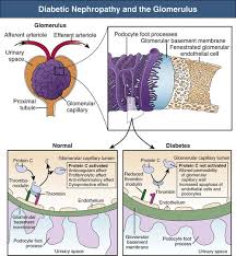 pathogenesis clinical manifestations