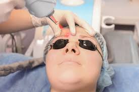 permanent makeup tattoo removal in