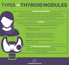 How To Shrink Thyroid Nodules Dr Izabella Wentz