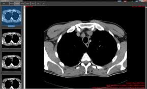 Radiology cafe's 'top pick' and 'one to watch' free dicom viewers for microsoft windows, apple macos and online. Orpalis Dicom Viewer Free