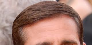 When choosing a los angeles hair transplant doctor, there are a number of important factors to be considered. Reconstructive And Hairline Revisions Using The Most Modern And Best Hair Transplant Techniques Best Hair Transplant Los Angeles Meshkin Medical 949 219 0027 Hair Transplant And Restoration Newport Beach