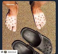 Don't wear crocs in the sun : r/funny