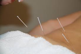 With the right acupuncture skills canada wants you! Acupuncture Industry In N S Has No Regulatory Body No Exams Halifaxtoday Ca