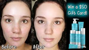 fade dark spots acne wrinkles
