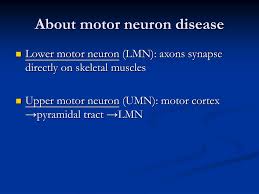 motor neuron disease