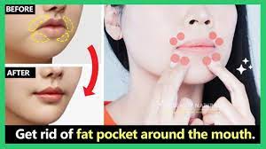 fat pocket around the mouth