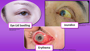 How To Assess The Eyes Nursing