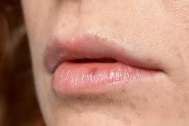 lip discoloration what it means