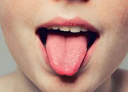 burning tongue treatments cincinnati oh