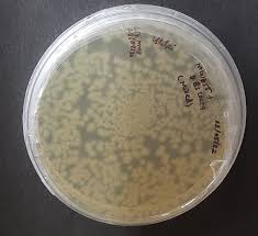 colony on my lb agar plates