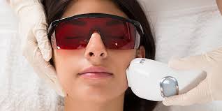 laser hair removal in bangalore cost