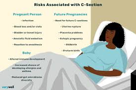 c section cesarean section purpose