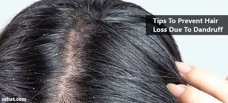 how to prevent hair loss due to dandruff