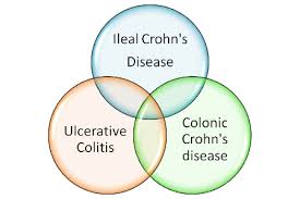 Crohns Vs Ulcerative Colitis Chart Human Para Foundation