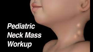 pediatric neck m workup what