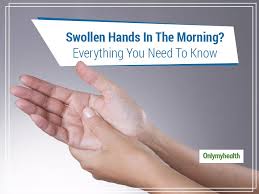 wave goodbye to swollen hands in the