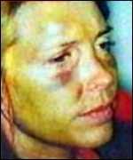 [ image: Margaret Moore said she was punched in the face 20 times] - _211614_mis_moore_with_bruises_150