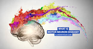 what is motor neuron disease als