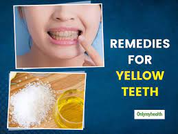 home remes to whiten yellow teeth
