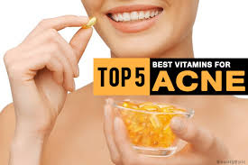 Rich in vitamins a and c, as well as magnesium, these herbs have been used for centuries for cleansing the body and thus clarifying the skin. Top 5 Best Vitamins To Prevent Acne