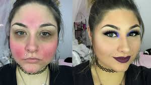 full coverage concealor and foundation for rosacea or severe acne beautybyjosiek 2016 you