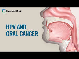 what is hpv cancer you