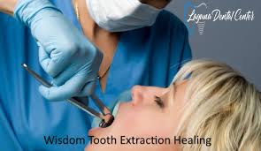 wisdom tooth removal recovery